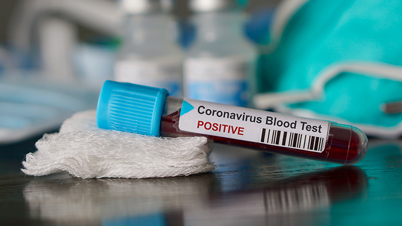 2 kişinin öldüğü İran'da 3 kişide daha Koronavirüs tespit edildi