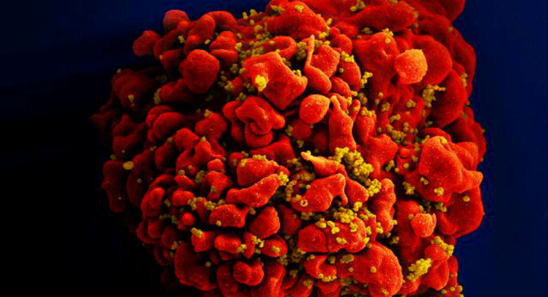 20 yıl sonra ilk kez yeni bir HIV türü keşfedildi