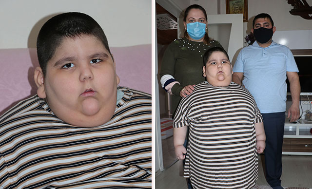 5 yaşındaki Yağız, 90 kilo: Solunum cihazıyla uyuyor