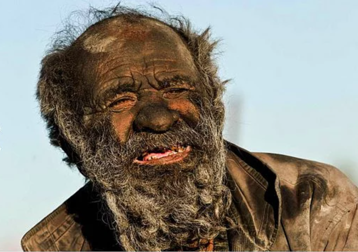65 yıldır yıkanmayan adam: 'Yıkanırsam hasta olurum'