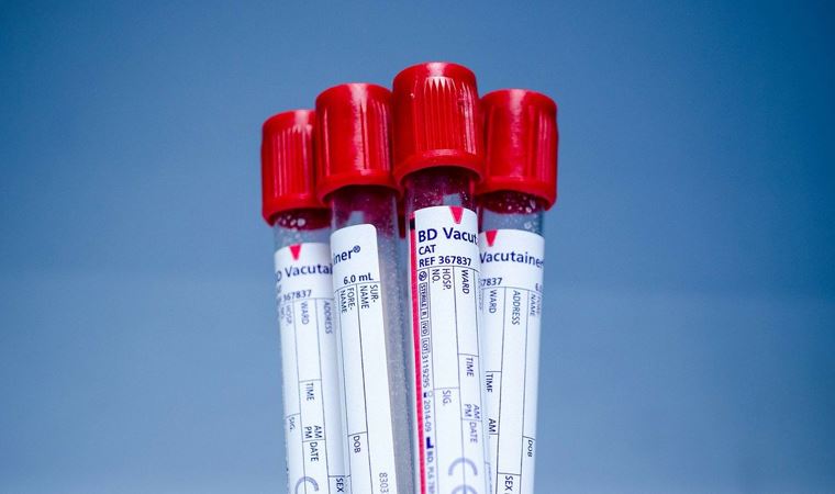 ABD'de ilk vakadan 1 ay önce toplanan kanlarda antikora rastlandı