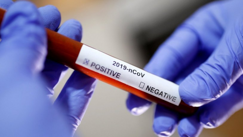 Bingöl'de şehir dışından gelenlerden kaynaklı koronavirüs vakası görüldü