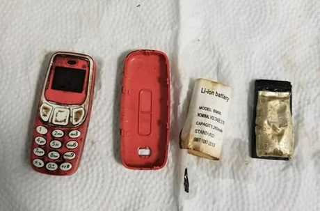 Bir hastanın midesinden Nokia 3310 çıktı