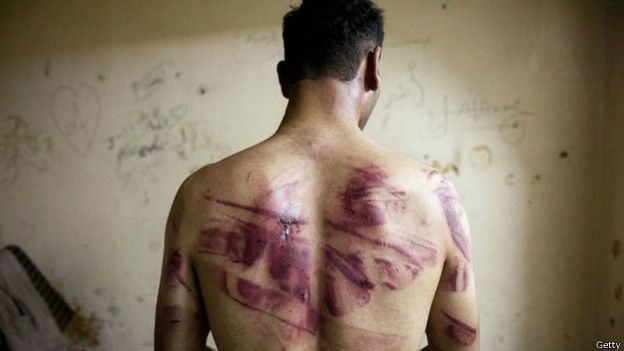 BM: Suriye hükümeti sivil nüfusu yok ediyor!