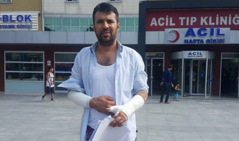 Cumartesi Anneleri eyleminde kolu kırılan Aydın Aydoğan’a 60 bin TL tazminat ödenecek