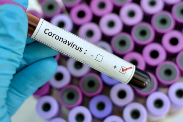 DSÖ: 167 bin koronavirüs vakası, 6 bin 606 ölü var