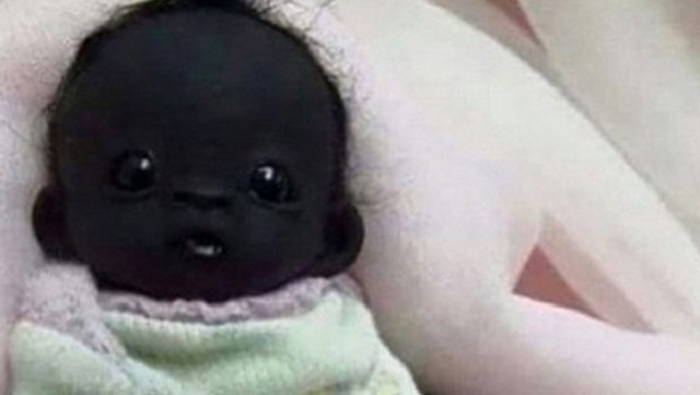 Dünyanın en siyah bebeği sosyal medyanın gündeminde!