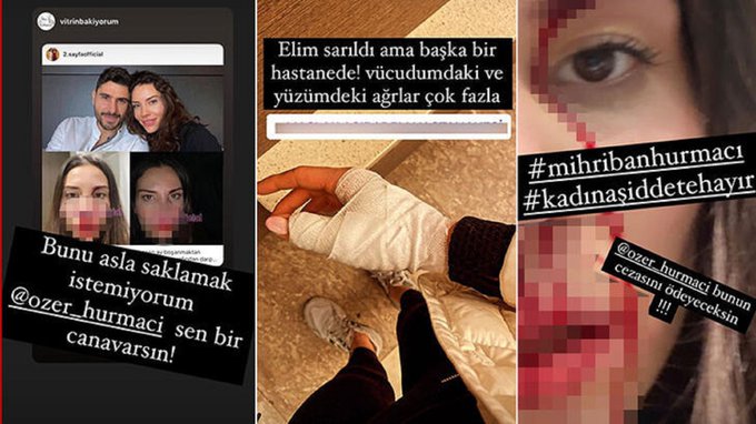 Futbolcu Özer Hurmacı'nın eşi Mihriban Hurmacı, eşinin kendisini darp ettiğini iddia etti 