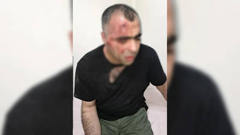 Gazeteci Sinan Aygül'ün uğradığı saldırıda 2. bir saldırgan yardımcı olmaya çalışanları silahla tehdit etti