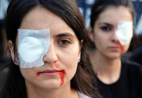 Polis, Gezi'de gözünü kaybeden 12 kişiyi arıyor!