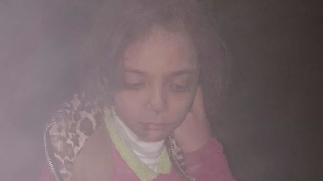 Halep'ten tweet atan 7 yaşındaki kız: Bunlar son günlerimiz olabilir