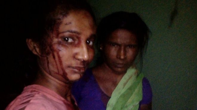 Hindistan'da bir kadın, keçisine saldıran kaplanı sopayla kovaladı