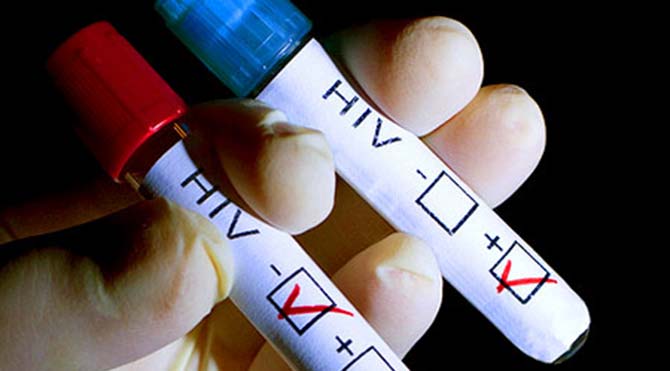 HIV bulaşmasında yüzde 450 artışın yaşandığı tek ülke Türkiye