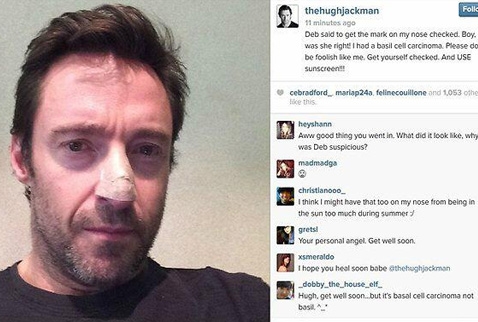 Hugh Jackman kansere yakalandı!