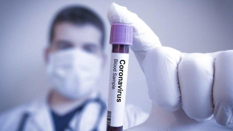 İran'da koronavirüs nedeniyle ölen sayısı 429'a ulaştı