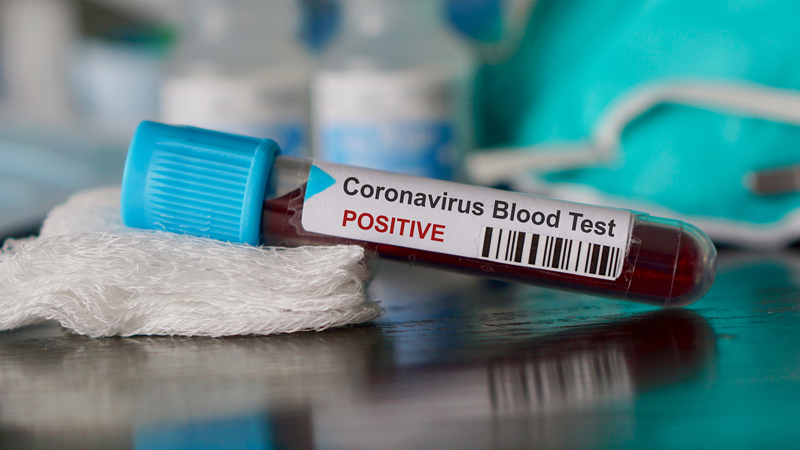 Kan grubuna göre Koronavirüs riski açıklandı