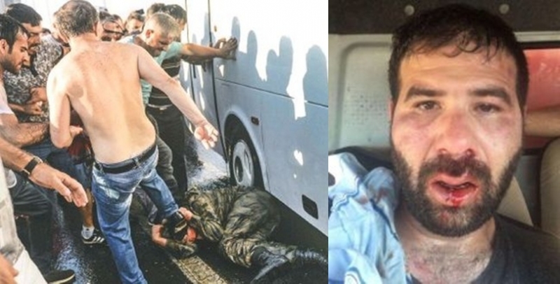 Köprüde dövülen Şamiloğlu: Gazeteci olduğumu söyleyince daha çok vurdular!
