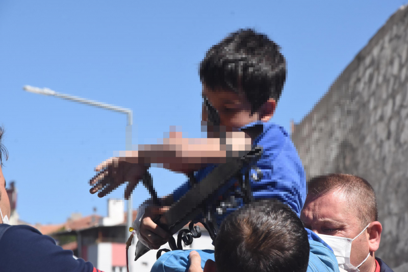Kütahya'da çocuğun koluna korkuluk demiri saplandı 