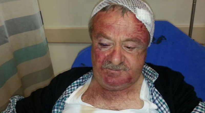 MHP'li meclis üyesi tekme tokat dövüldü!