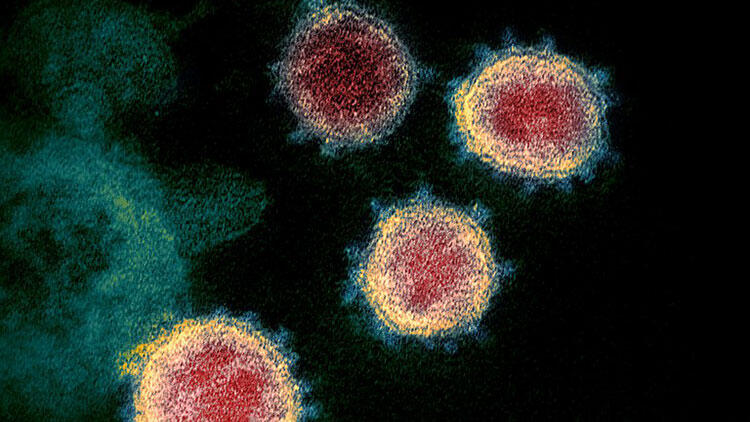 Otopsi raporu: Koronavirüs ölümden sonra akciğerde kalmaya devam ediyor