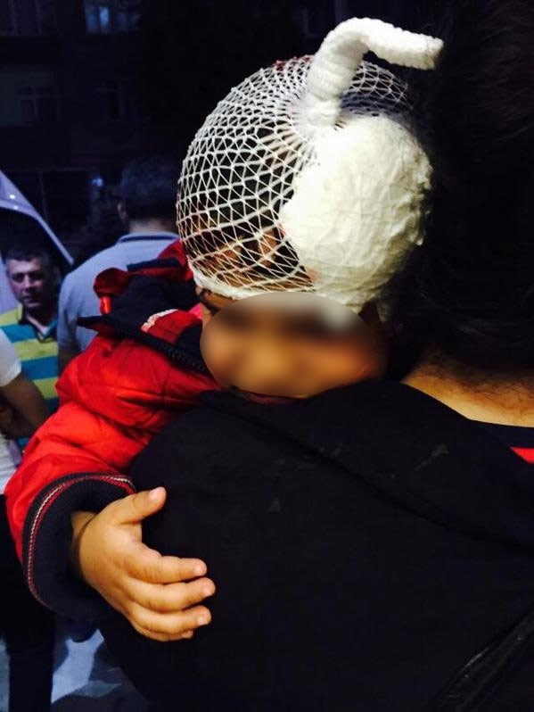 Polis 2 yaşındaki çocuğu gaz bombasıyla başından vurdu!