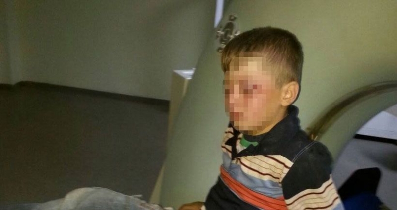 Polis Cizre'de 8 yaşındaki çocuğu vurdu!