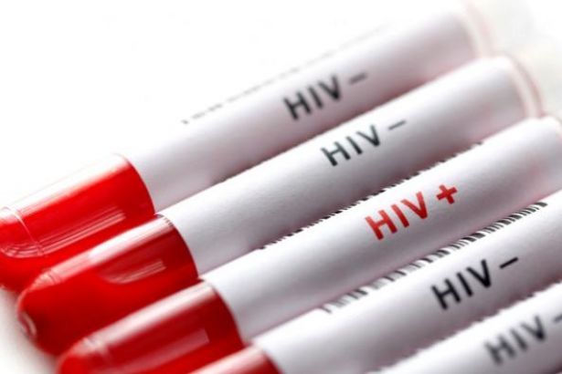 Sağlık Bakanlığı: Türkiye'de 15 binden fazla HIV taşıyıcısı var