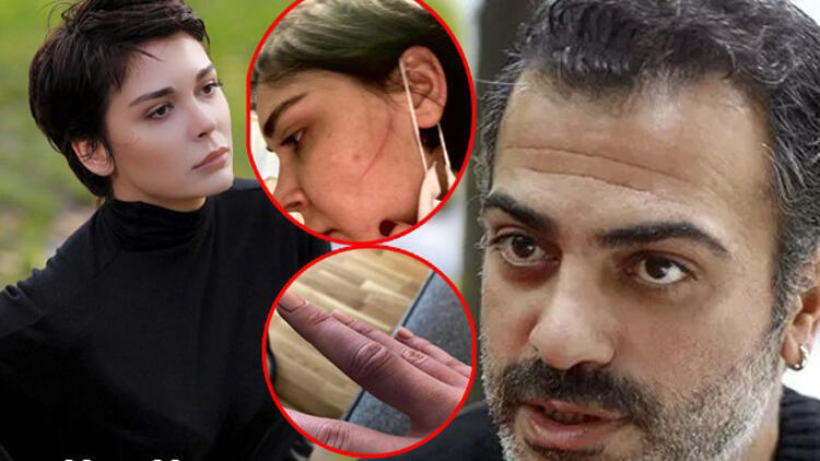 Sermiyan Midyat ve Sevcan Yaşar'a 'yaralama' suçundan para cezası