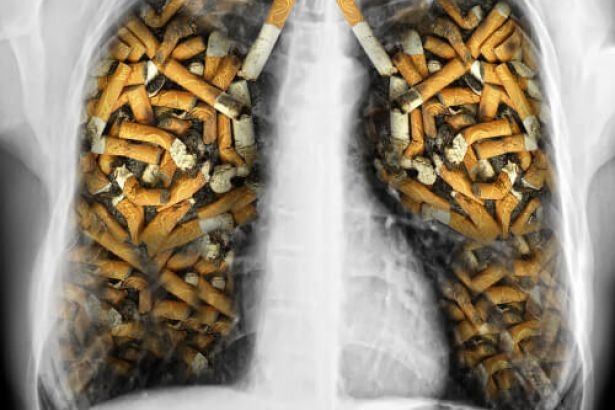 Sigara nasıl kanser yapıyor?