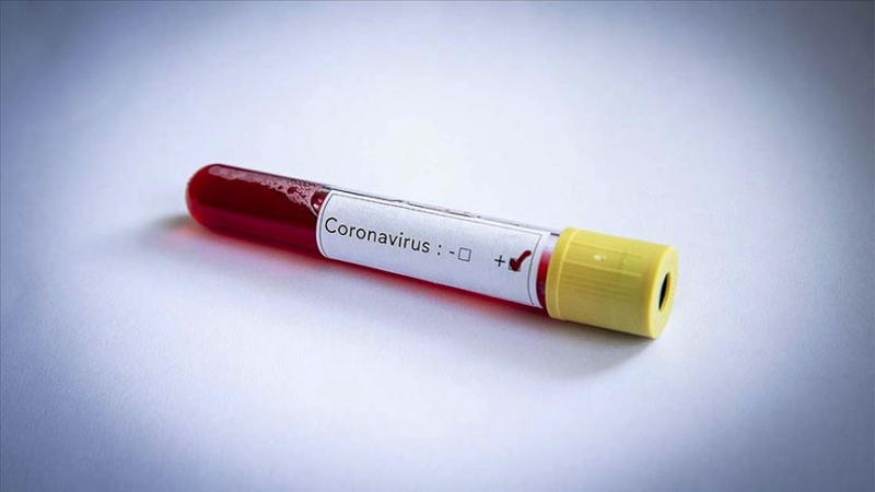 Temasta bulunduğu kişileri bildirmeyen koronavirüs hastası hakkında soruşturma