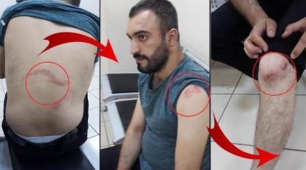 Terzide pantolon paçasına kızan polis 'Erdoğan'a hakaretten' işkence yaptı!'