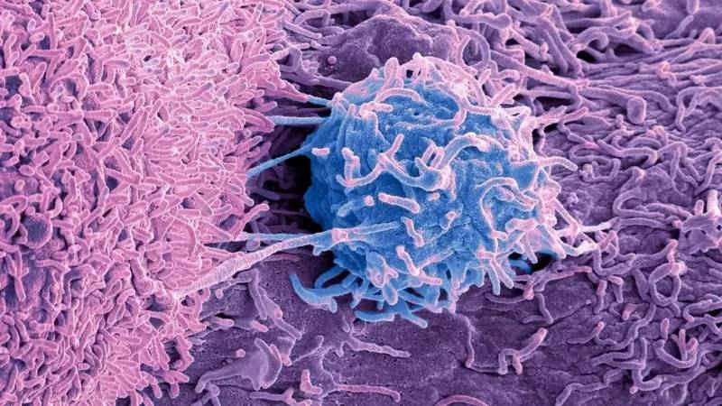 Tümörlerde yaşayan mikroplar, kanserin nedeni ve tedavisiyle ilgili ne tür ipuçları veriyor?