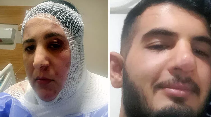 Üvey annesine kezzapla saldıran Bilal Arık tutuklandı