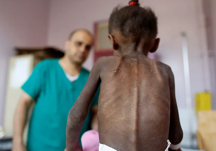 'Yemen'de milyonlarca çocuk açlık tehdidiyle karşı karşıya'