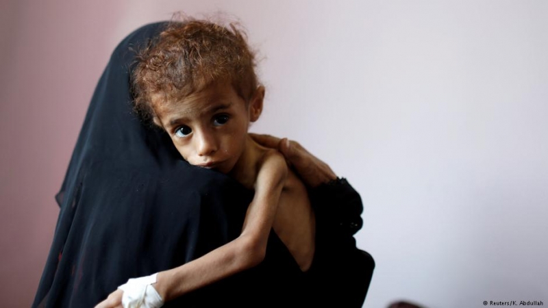 Yemen’de nüfusun yüzde 70'i açlıkla savaşıyor