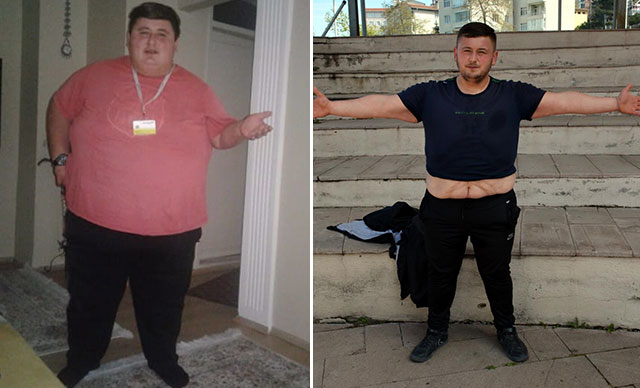 Zonguldak'ta sevgilisi beğenmeyince 212 kilo verdi