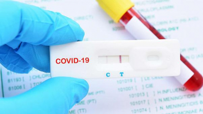 Araştırma: Her beş Covid-19 hastasından biri akıl hastalığına yakalanıyor