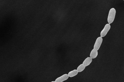 Dünyanın en büyük bakterisi bulundu: Çıplak gözle görülebiliyor