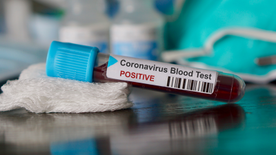 Koronavirüs nedeniyle ölenlerin sayısı 300'ü geçti; Çin dışında ilk ölüm vakası görüldü 