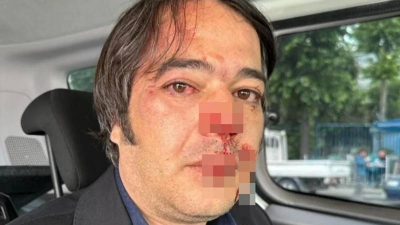 Üsküdar'da İBB'nin imar şube müdürüne saldırıyla ilgili bir kişi tutuklandı